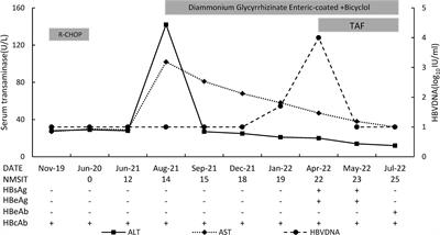 A case report of hepatitis B virus reactivation 19 months after cessation of chemotherapy with rituximab